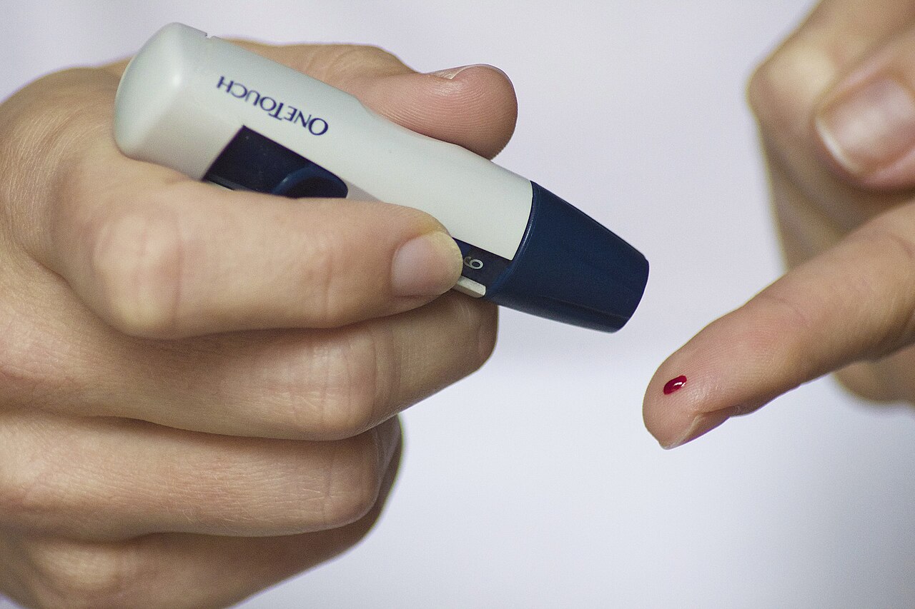 Una mano sostiene un dispositivo para pinchar el dedo y sacar una gota de sangre para medir el azúcar