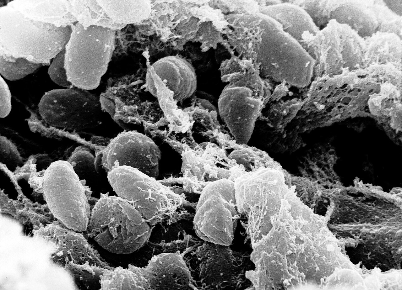 Micrografía electrónica de barrido de una masa de bacterias Yersinia pestis, causante de la peste